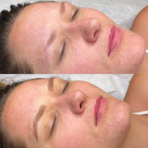 A woman is sleeping with her eyes closed.