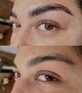 A before and after picture of the same woman 's eyes.