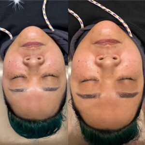 A woman with green hair is getting her face waxed.