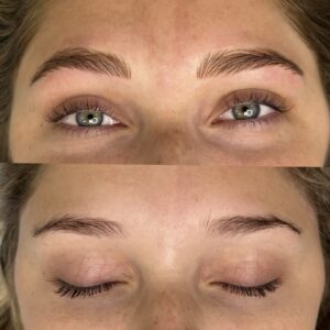 A before and after picture of the same woman 's eyes.