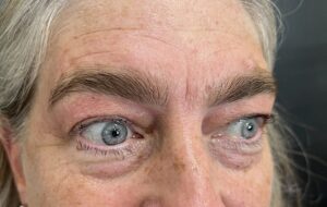 A man with blue eyes and white hair.