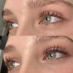 A before and after picture of the same woman 's eyes.