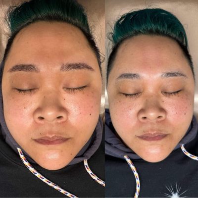 A before and after photo of a woman with green hair.