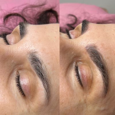 A woman with her eyes closed and the brows being tattooed.