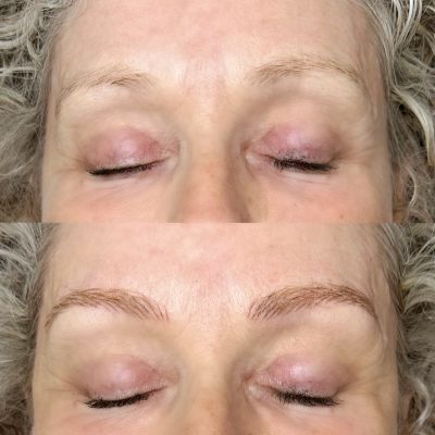 A before and after picture of a woman 's eyebrows.