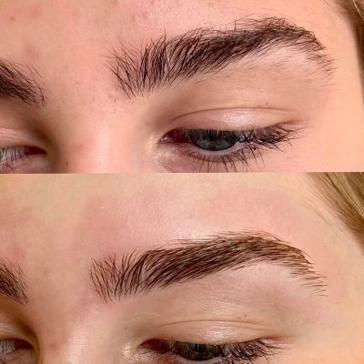A before and after picture of the brows of a woman.